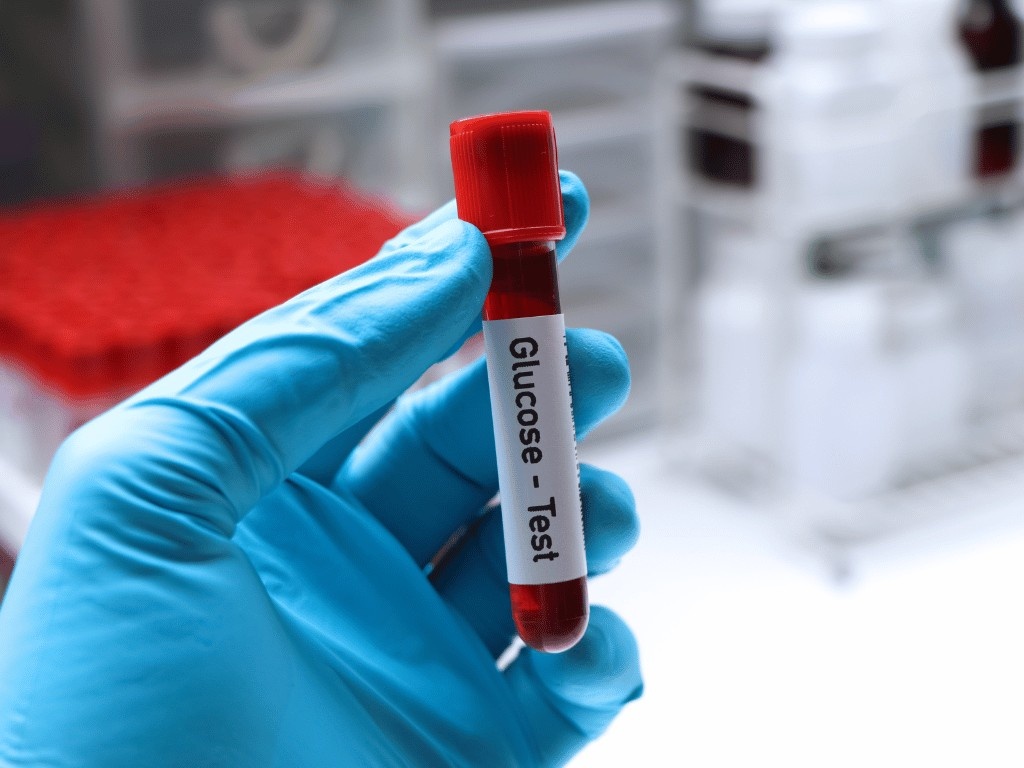 Gloved hand holding a glucose test tube shows fasting blood tests used to measure blood sugar and metabolic health