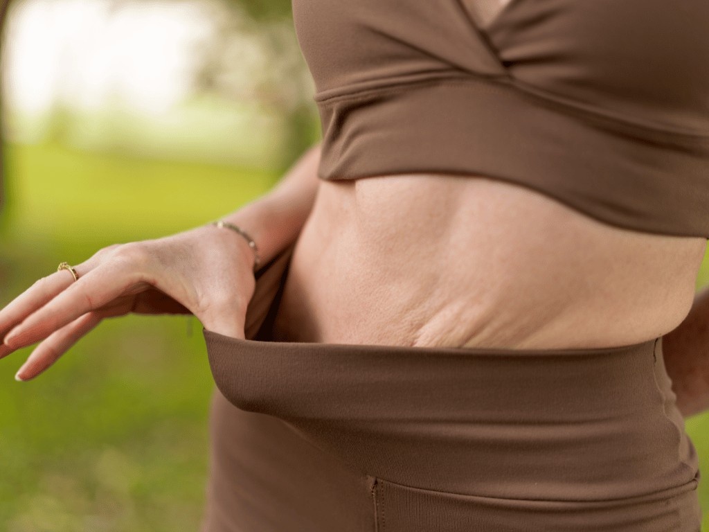 Woman pulling waistband to show postpartum belly after pregnancy weight loss.