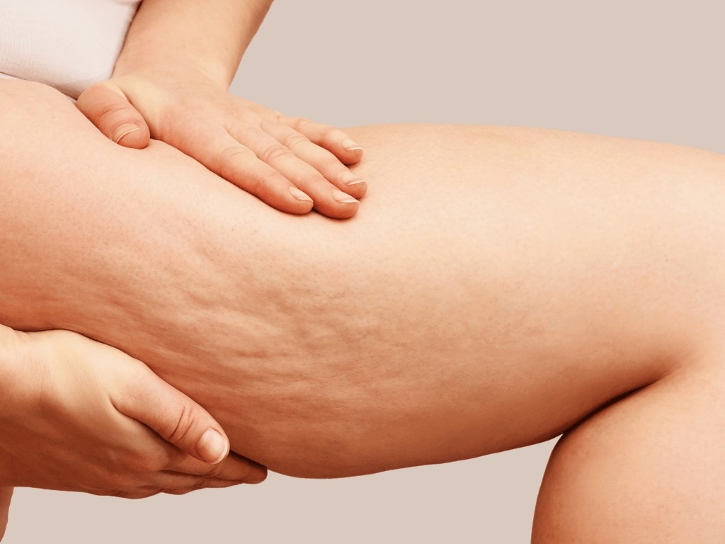 A person holding their thigh showing cellulite and body fat, and how to lose thigh fat naturally with Eato.