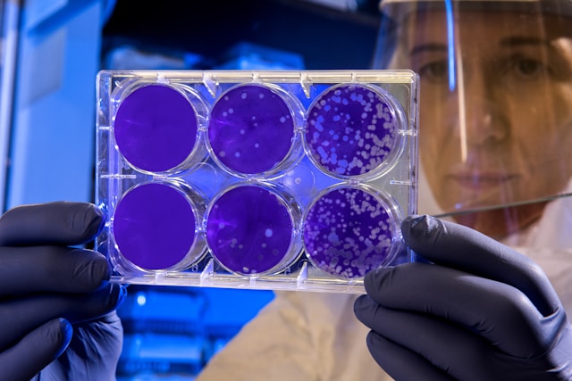 Researcher holding a plate with bacterial cultures