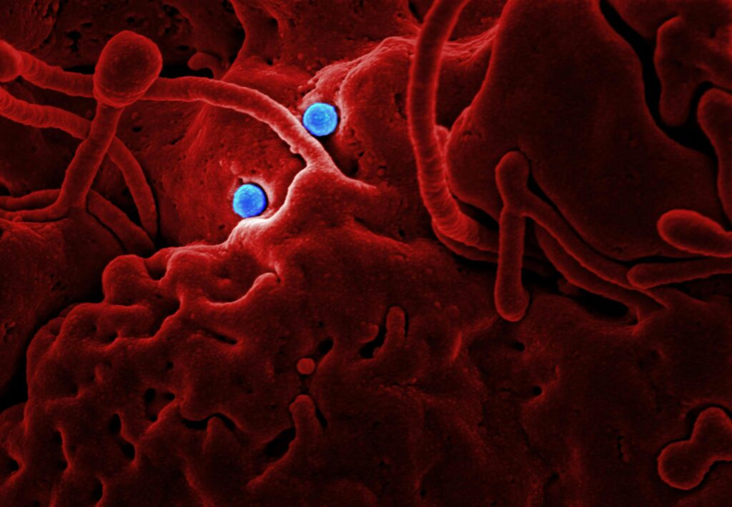 Microscopic view of gut bacteria with red structures and two bright blue cells shown in as bacterial fermentation produces gas.